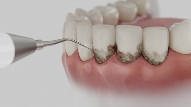 Reliable Teeth Cleaning And Checkup contractor in Carteret County County, NC by Dentist Open Now